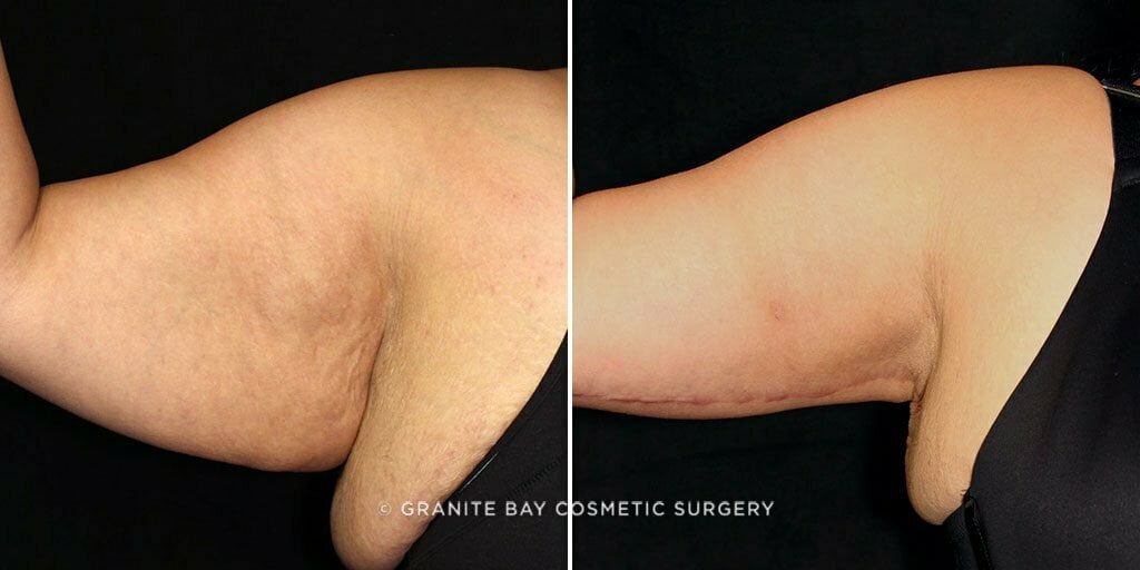 Case # 6 after photo