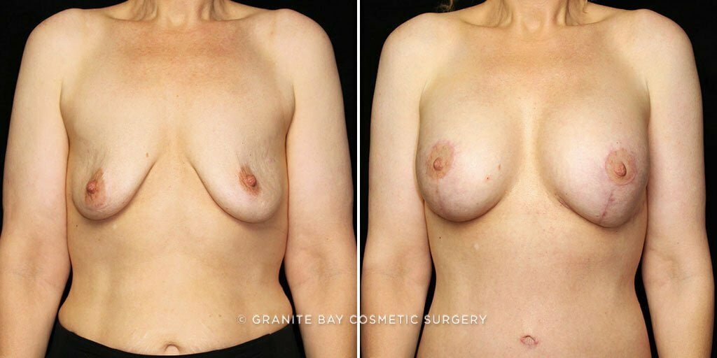 Case # 29 after photo