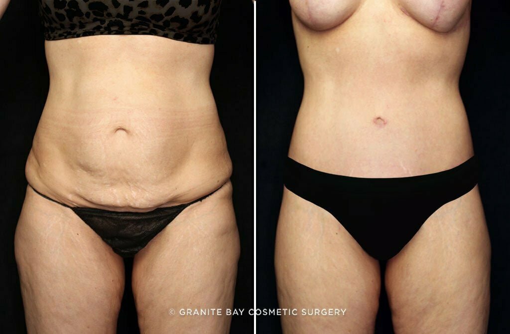 Case # 6 after photo