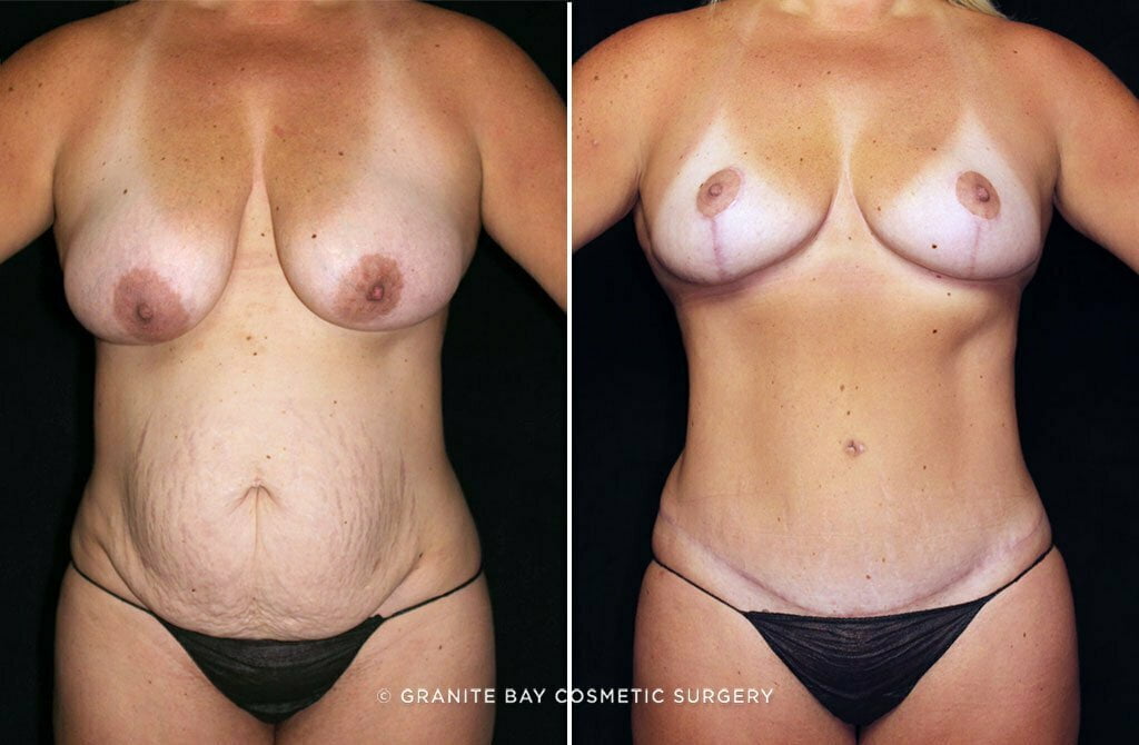 Case # 42 after photo