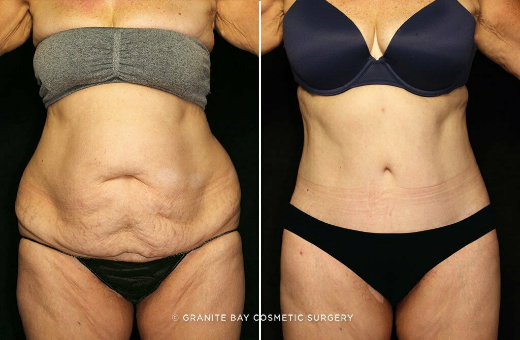 Case # 7 after photo