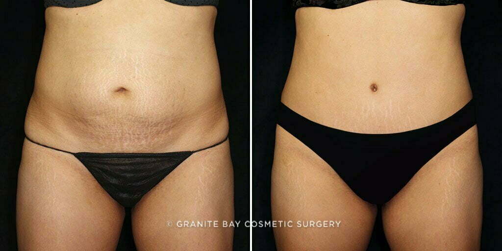 Case # 70 after photo