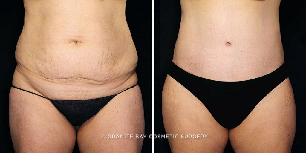 Case # 71 after photo