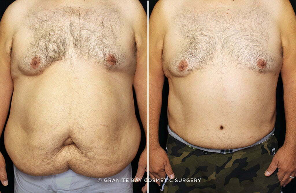 Case # 8 after photo