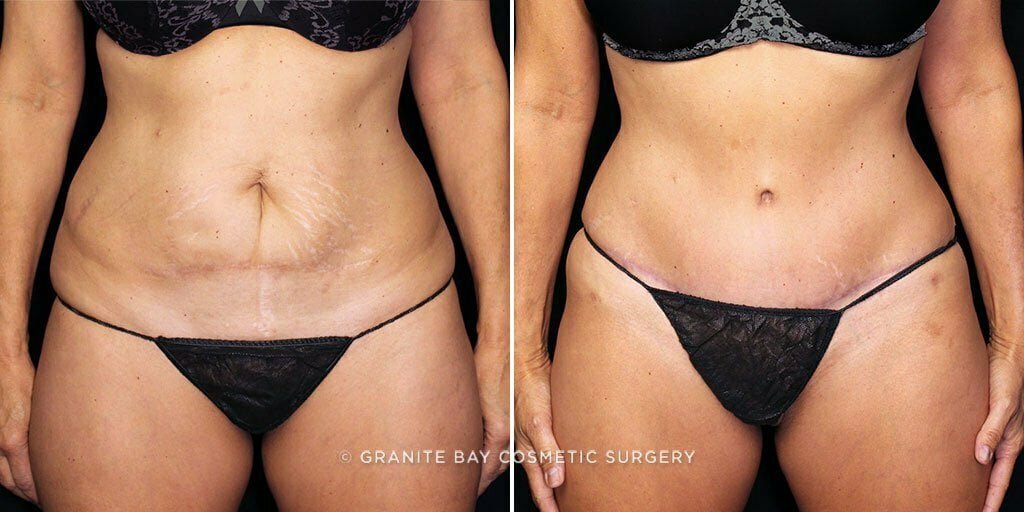 Case # 72 after photo