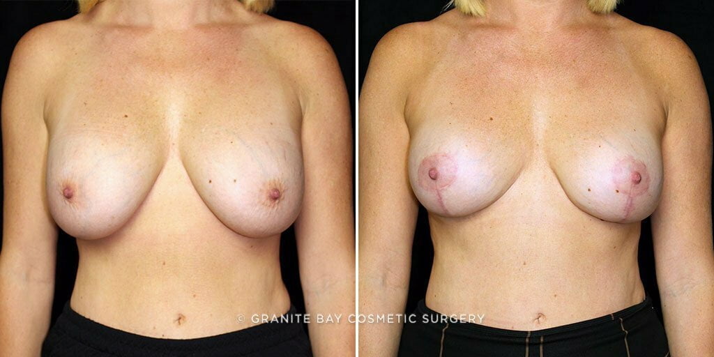 Case # 27 after photo