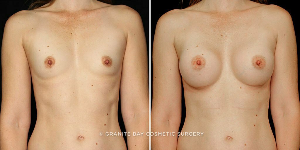 Case # 69 after photo