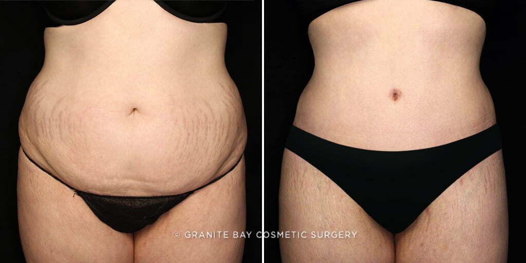 Case # 74 after photo