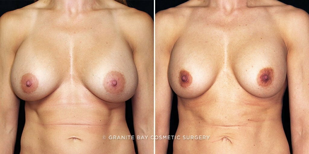 Case # 39 after photo