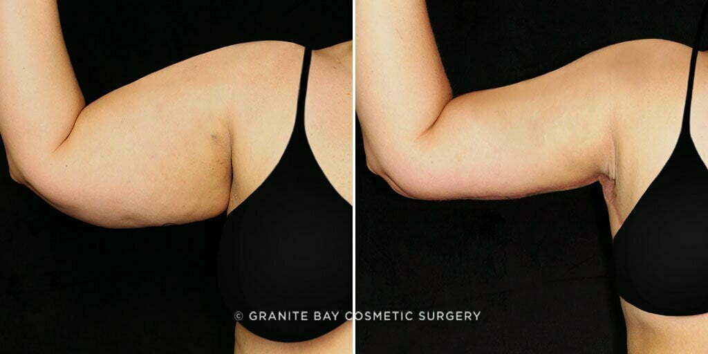 Case # 7 after photo