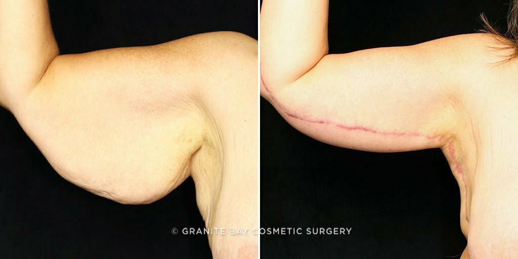 Case # 8 after photo