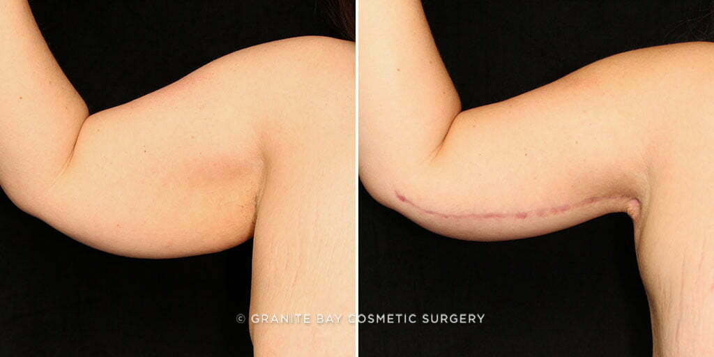 Case # 9 after photo