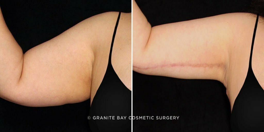 Case # 10 after photo