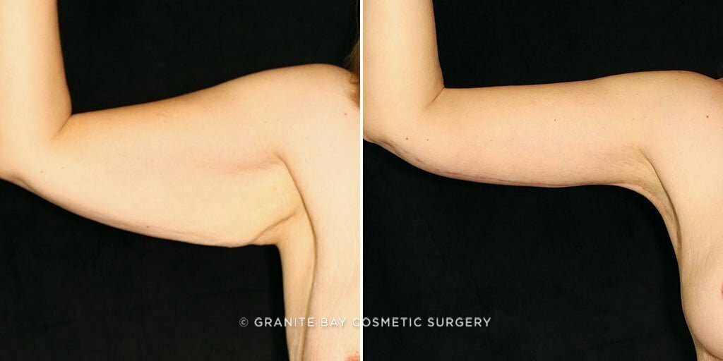 Case # 11 after photo