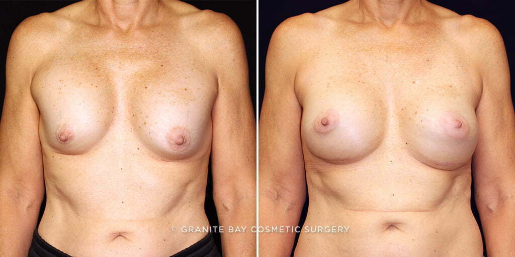 Case # 40 after photo