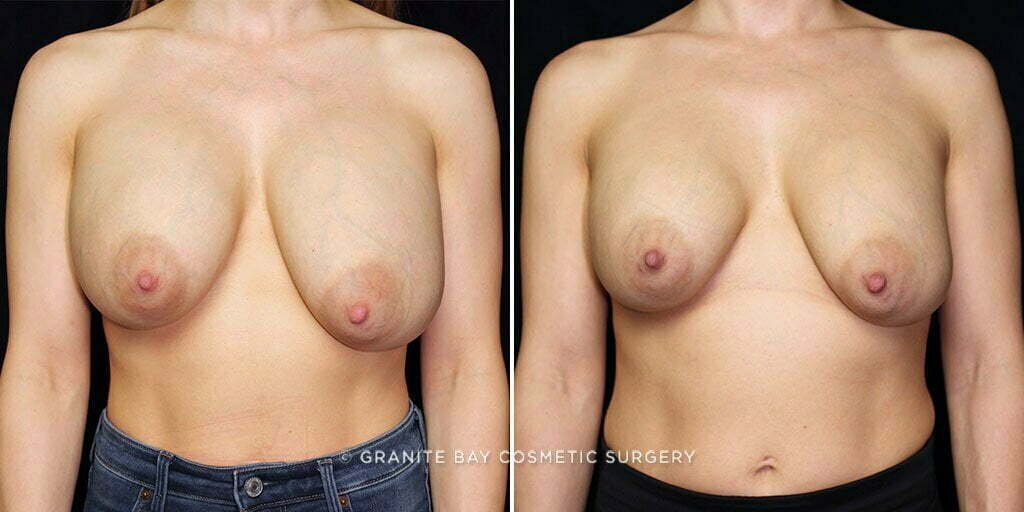 Case # 43 after photo