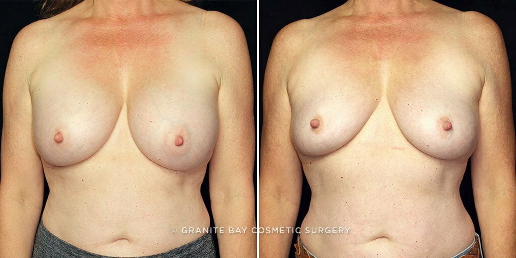 Case # 29 after photo