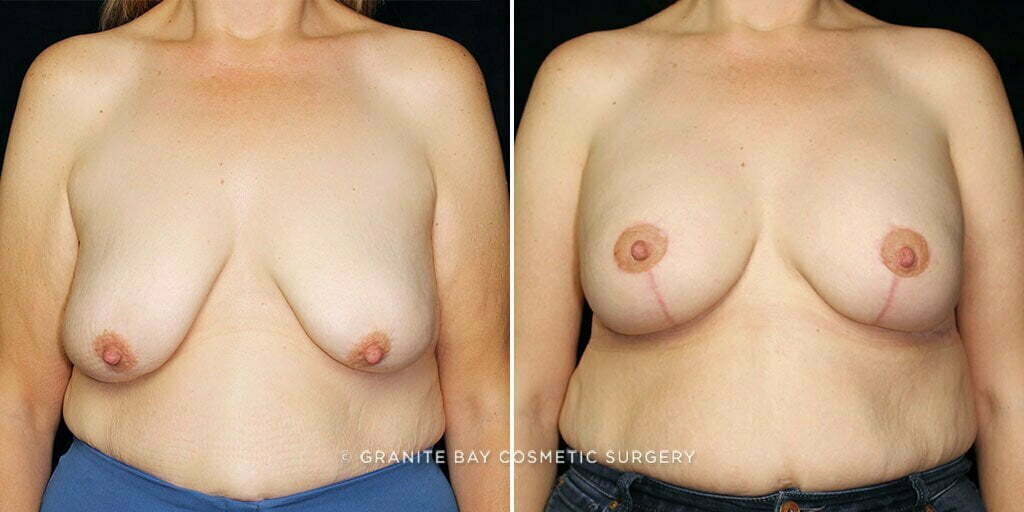 Case # 30 after photo