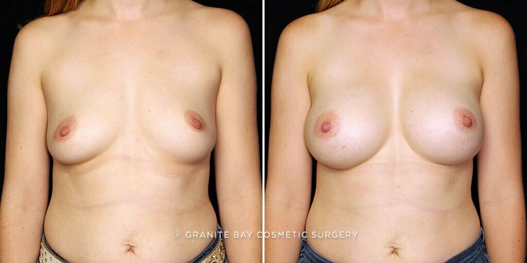 Case # 70 after photo