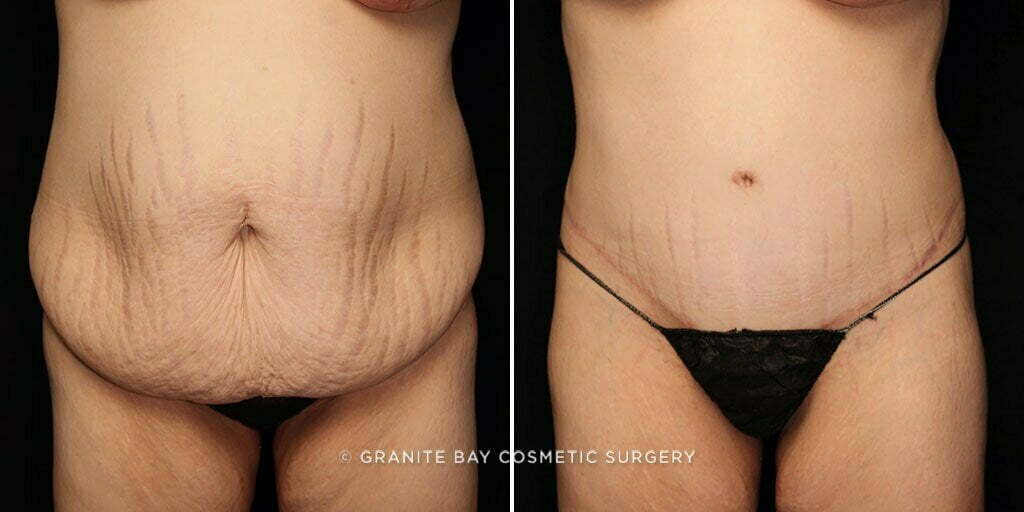 Case # 75 after photo