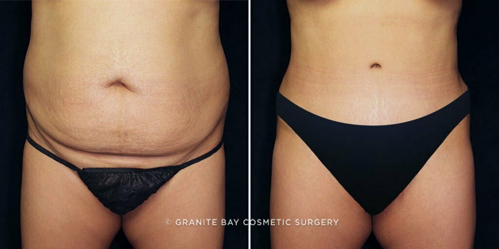 Case # 76 after photo