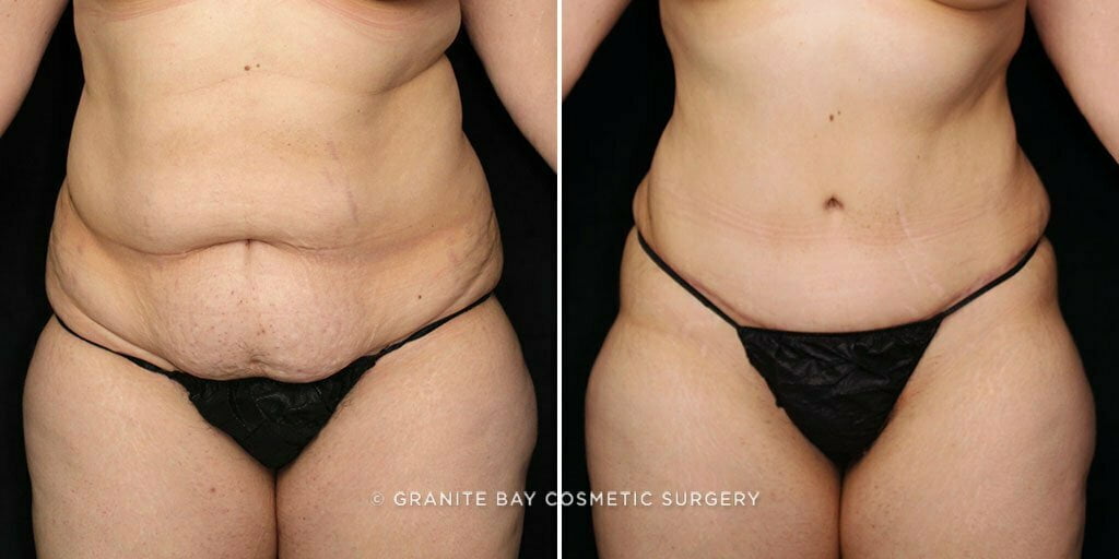 Case # 77 after photo