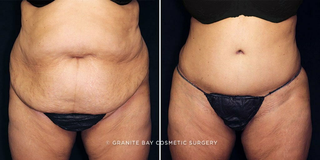 Case # 78 after photo