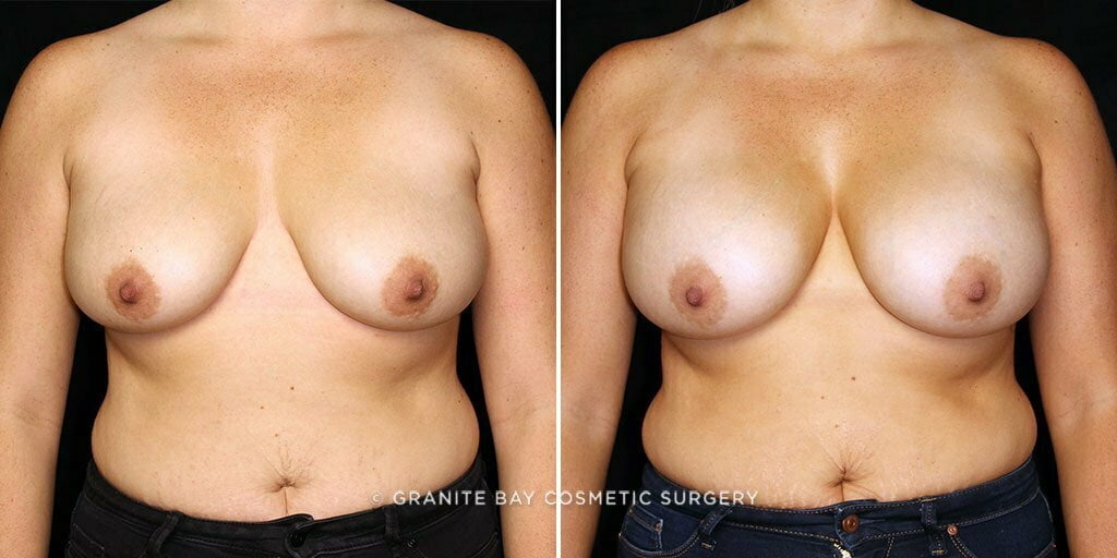 Case # 72 after photo