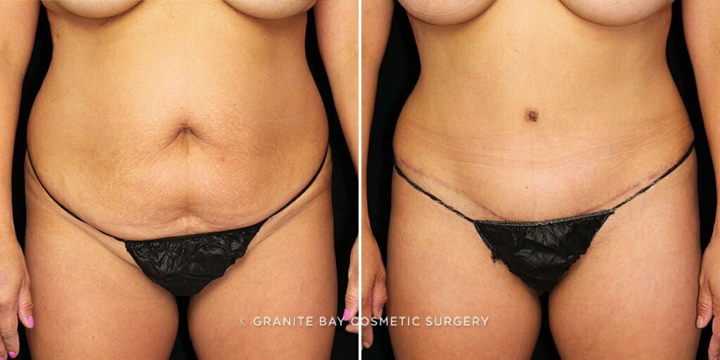 Case # 80 after photo