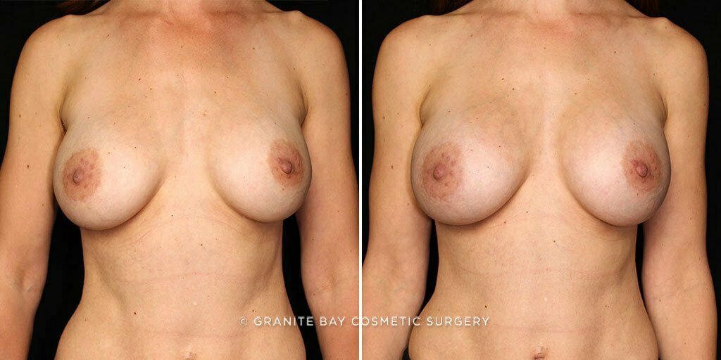 Case # 49 after photo