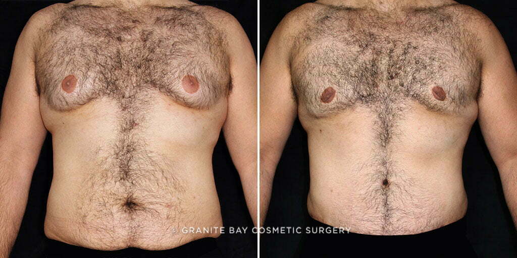 Case # 7 after photo