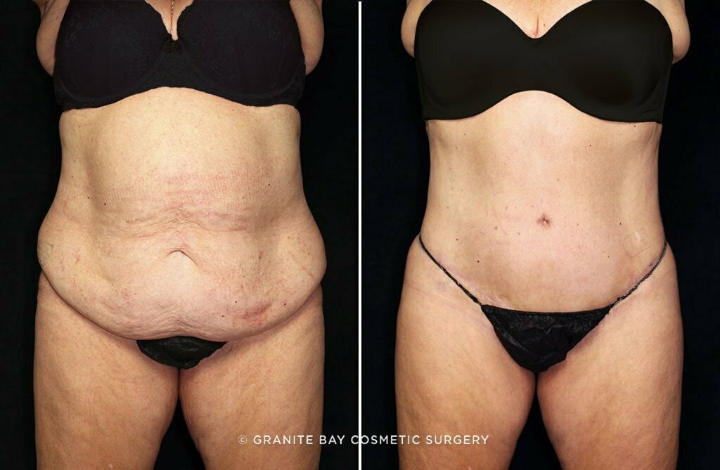 Case # 9 after photo