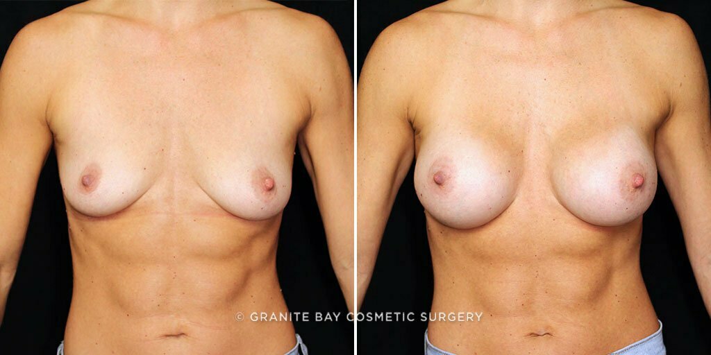 Case # 73 after photo