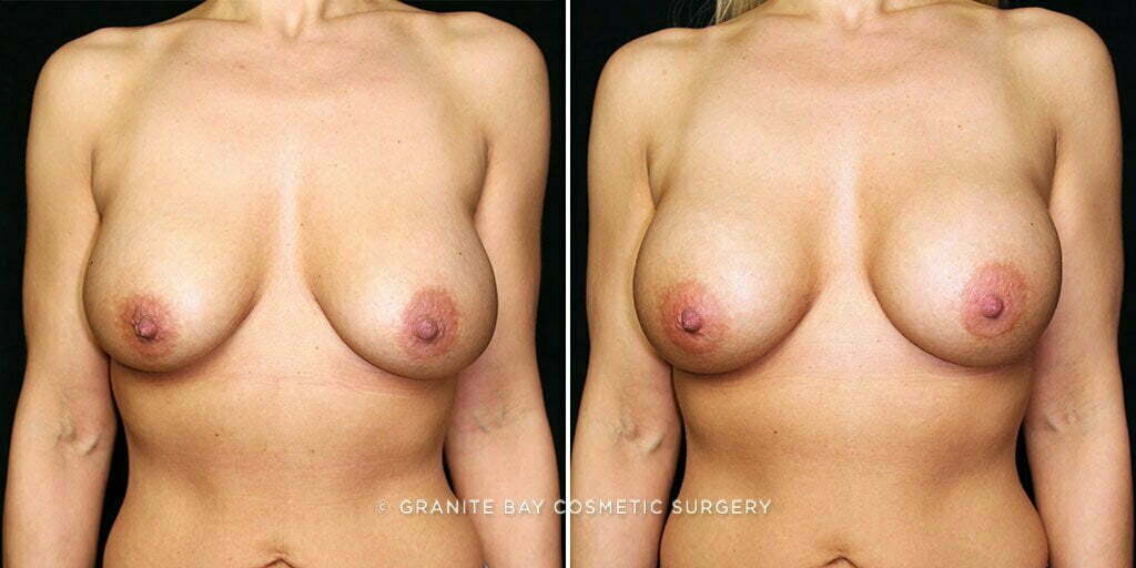 Case # 51 after photo