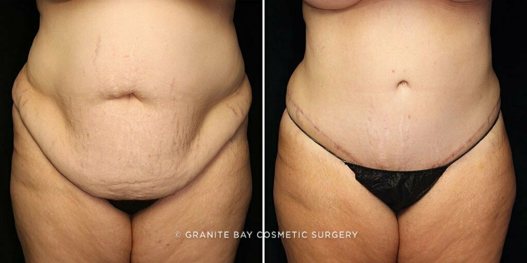 Case # 81 after photo