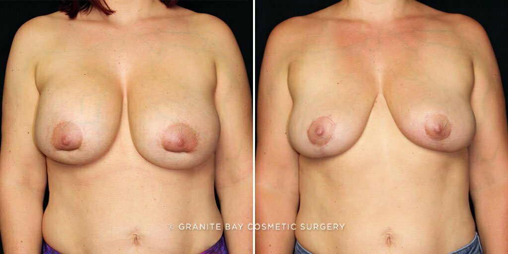 Case # 34 after photo