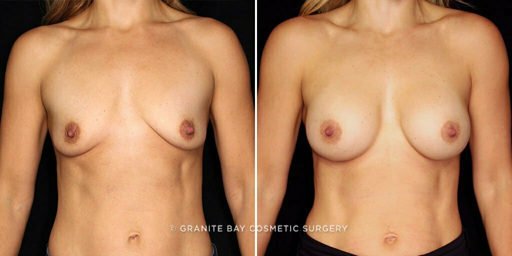 Case # 74 after photo