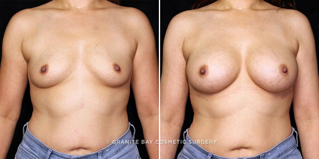 Case # 75 after photo