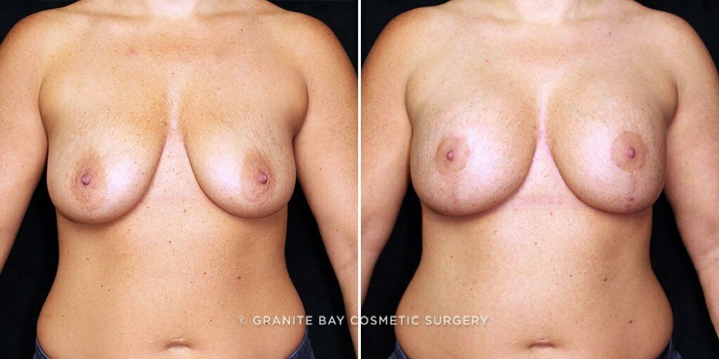 Case # 32 after photo