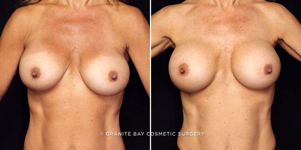 Case # 55 after photo