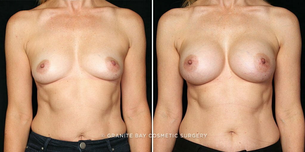 Case # 78 after photo