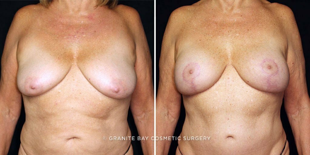 Case # 35 after photo