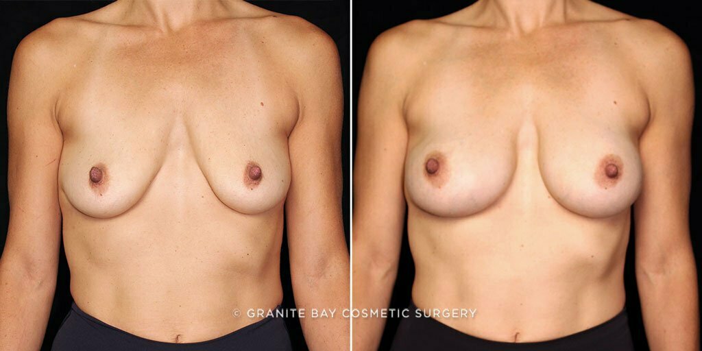 Case # 80 after photo