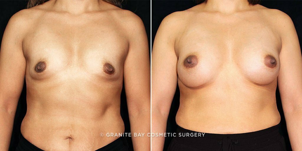 Case # 83 after photo