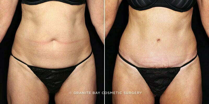 Case # 82 after photo