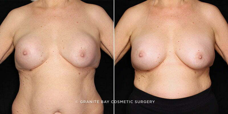 Case # 58 after photo