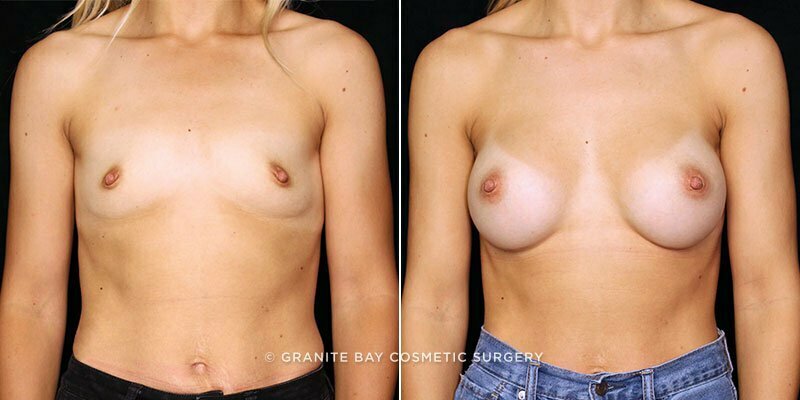 Case # 86 after photo