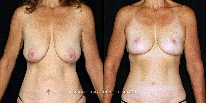 Case # 20 after photo