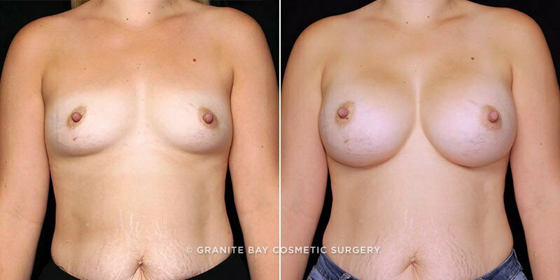 Case # 87 after photo