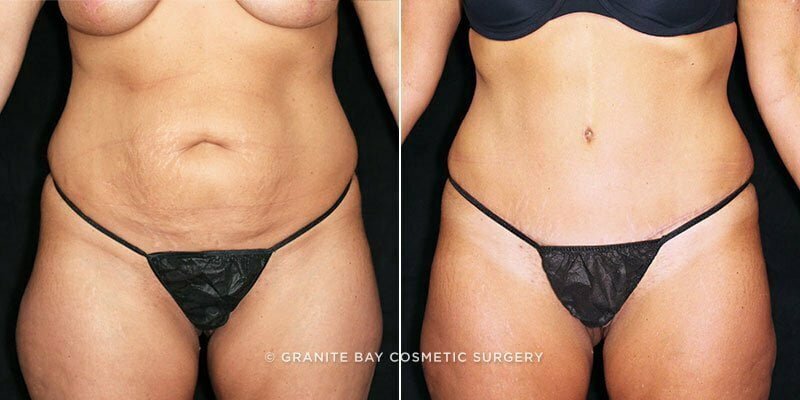 Case # 87 after photo